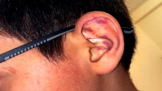 بني بوعياش.. أستاذ يضرب تلميذًا ويتسبب له في عجز لمدة 15 يومًا