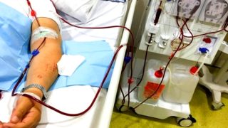 عطب بأجهزة تصفية الكلي بمستشفى إمزورن يهدد حياة مرضى القصور الكلوي